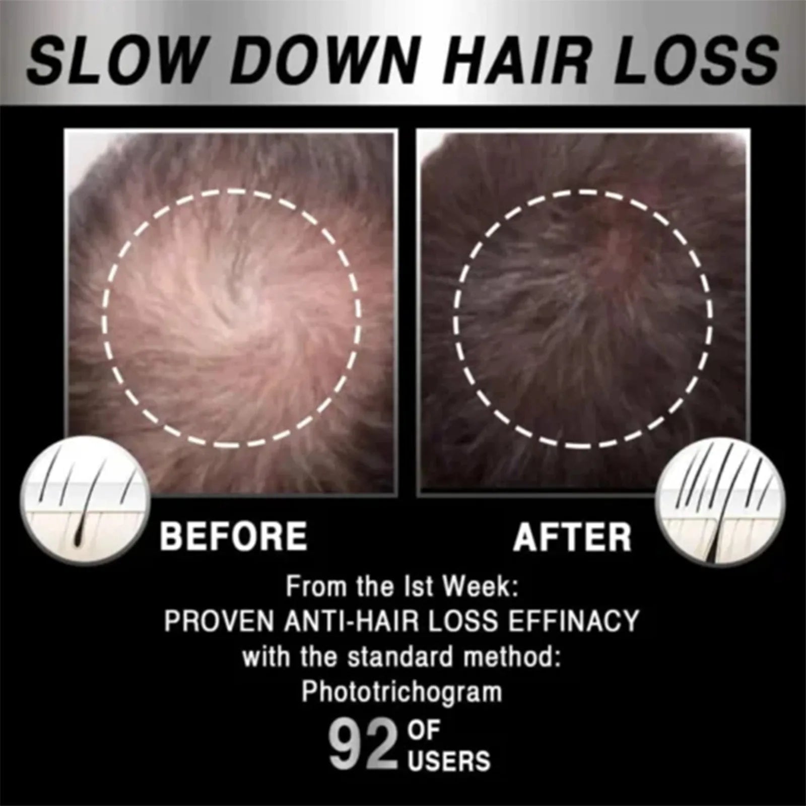 Heated Hair Cap - Cap Trimmers