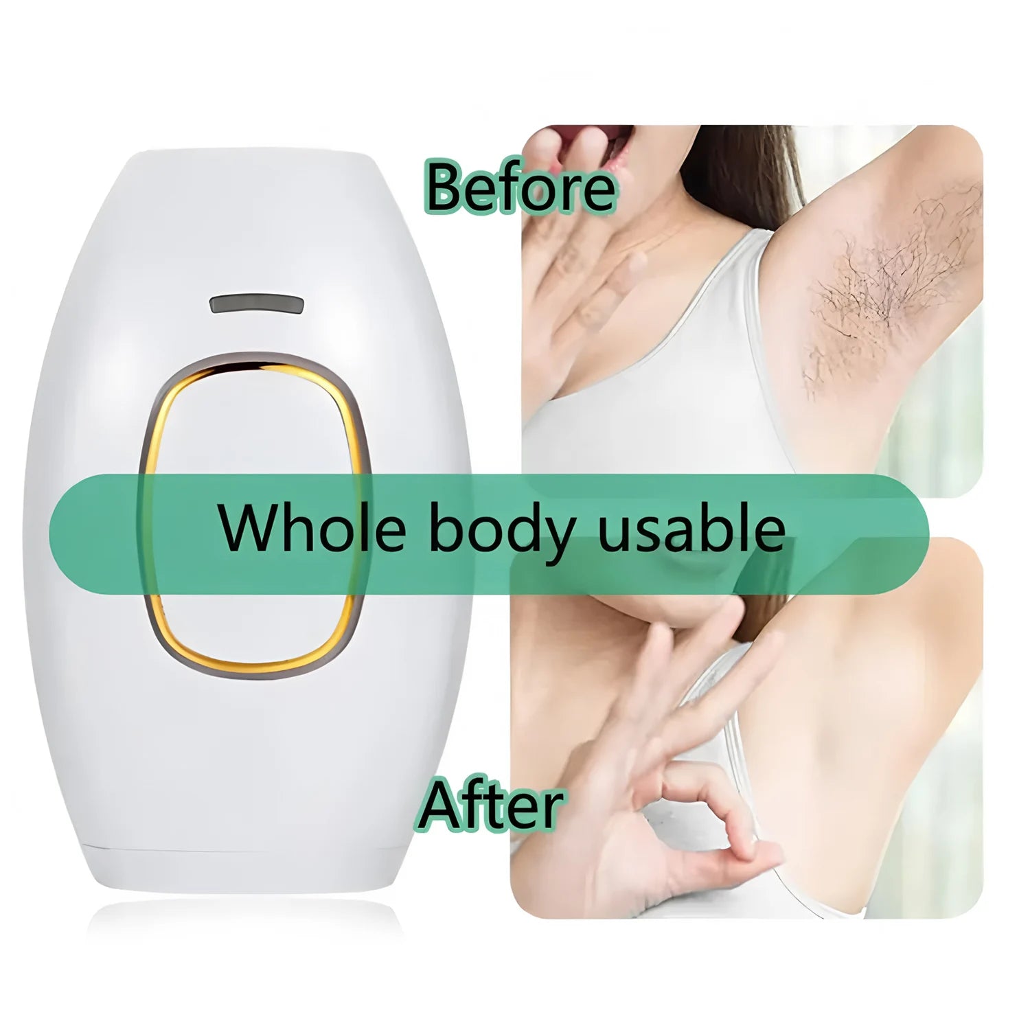 Laser Hair Removal Device - Cap Trimmers