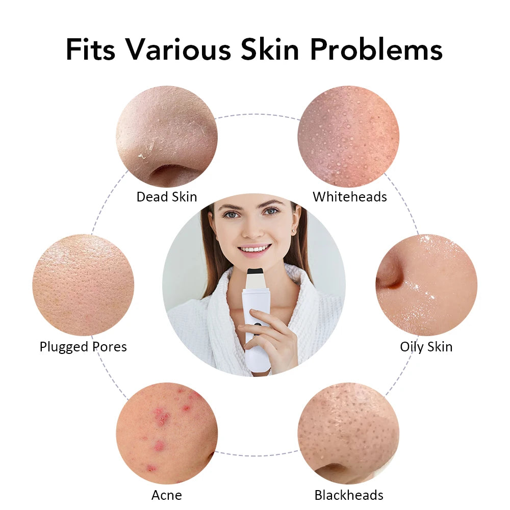 Ultrasonic Skin Scrubber - Cap Trimmers